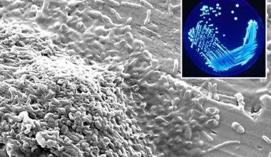 Cluster of Legionnaire's disease cases found in NYC as health officials on alert