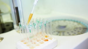No DTC genetic testing of teens for ‘looks’: gov't guideline to say