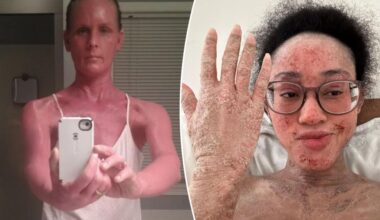 Scary condition that 'traps you in your own half-alive corpse'