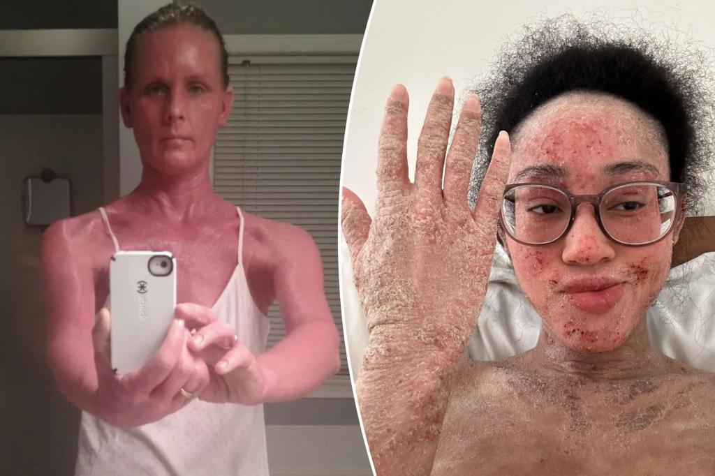 Scary condition that 'traps you in your own half-alive corpse'