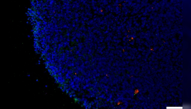 Microscopy image of a human retinal organoid that has been exposed to SARS-CoV-2