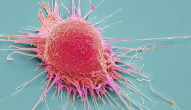 How prostate cancer turns immune cells into traitors