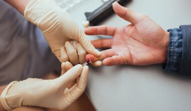New Clozapine Consensus Guidelines Drop ANC Monitoring