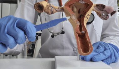Medical model of a uterus