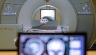 Man pulled into MRI machine after he walked into an exam room wearing a chain necklace