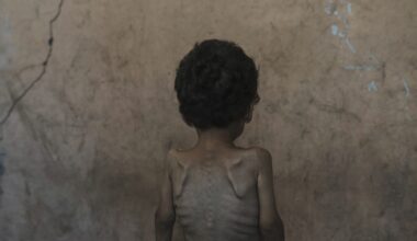 Witnesses and data say malnutrition-related deaths in Gaza have shot up