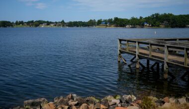 What to know about deadly brain-eating amoeba