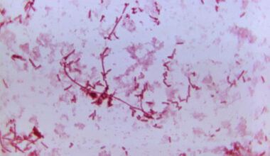 Highly magnified microscopic image showing numerous rod-shaped Yersinia pestis bacteria, some arranged in chains and clusters, dispersed across the visual field. The bacteria appear as slender, elongated rods with distinct groupings, typical of Gram-negative morphology. This image, taken at 1125X magnification, reveals the cellular structure and distribution pattern of the plague-causing organism, offering a detailed view relevant to microbiological and epidemiological research.