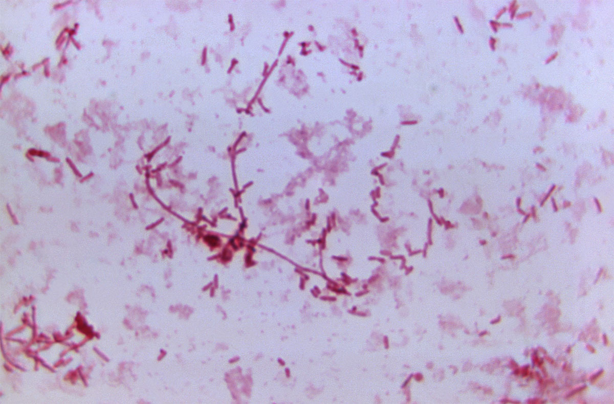 Highly magnified microscopic image showing numerous rod-shaped Yersinia pestis bacteria, some arranged in chains and clusters, dispersed across the visual field. The bacteria appear as slender, elongated rods with distinct groupings, typical of Gram-negative morphology. This image, taken at 1125X magnification, reveals the cellular structure and distribution pattern of the plague-causing organism, offering a detailed view relevant to microbiological and epidemiological research.