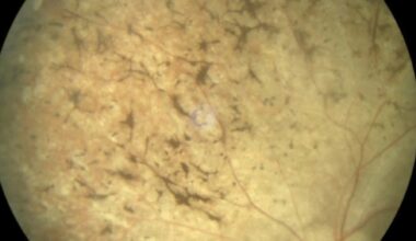 Incidental diagnosis of Bardet–Biedl syndrome in a case of abdominal tuberculosis: a case report | Journal of Medical Case Reports