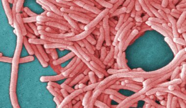 Harlem Legionnaires' outbreak: 2 people dead among 58 diagnosed in outbreak since July 25