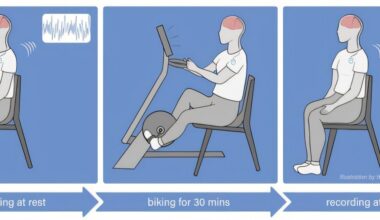 Long-term exercise may help restore brain connections in Parkinson's disease