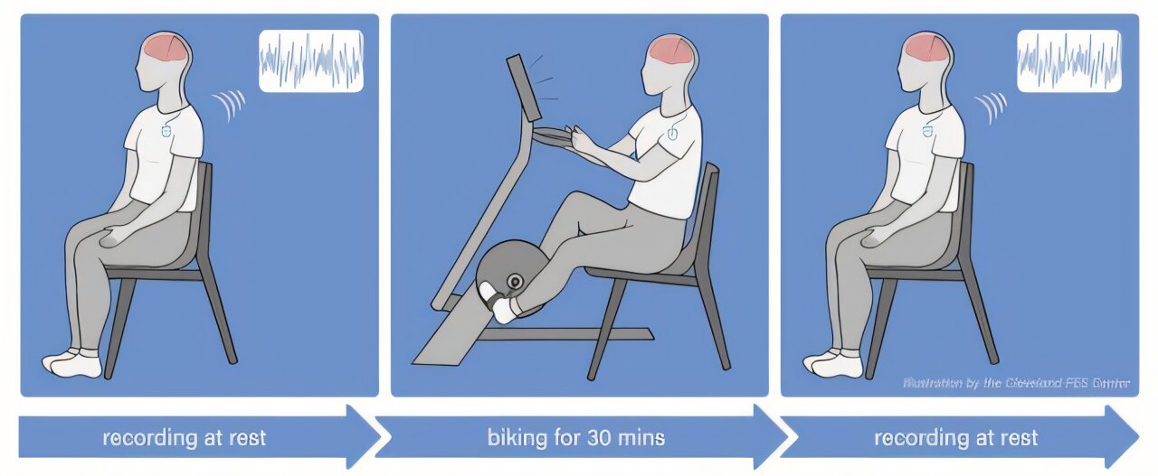 Long-term exercise may help restore brain connections in Parkinson's disease