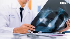 Non-smokers account for 20% of lung cancer diagnoses