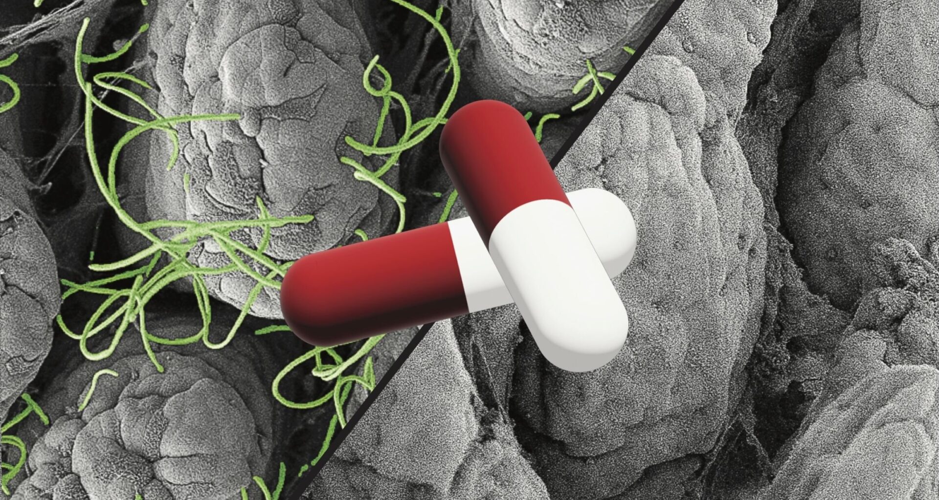 Non-antibiotic drugs can also disrupt the microbiome