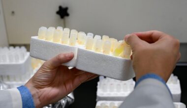 Harvard study linking lithium loss to Alzheimer's disease brings hope on LI