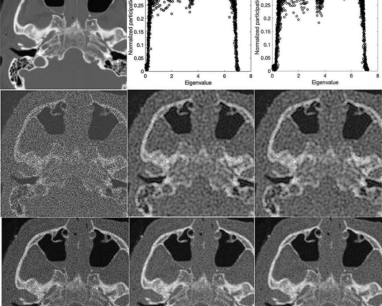 Next-level pixel-particle analogy uses quantum-inspired math to clarify noisy medical images