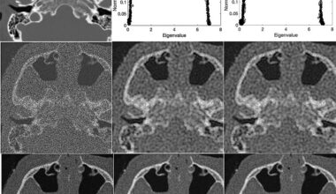 Next-level pixel-particle analogy uses quantum-inspired math to clarify noisy medical images