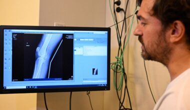 AI Tools May Degrade Doctors’ Skills