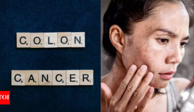 Colon cancer symptoms on skin: What you need to know |
