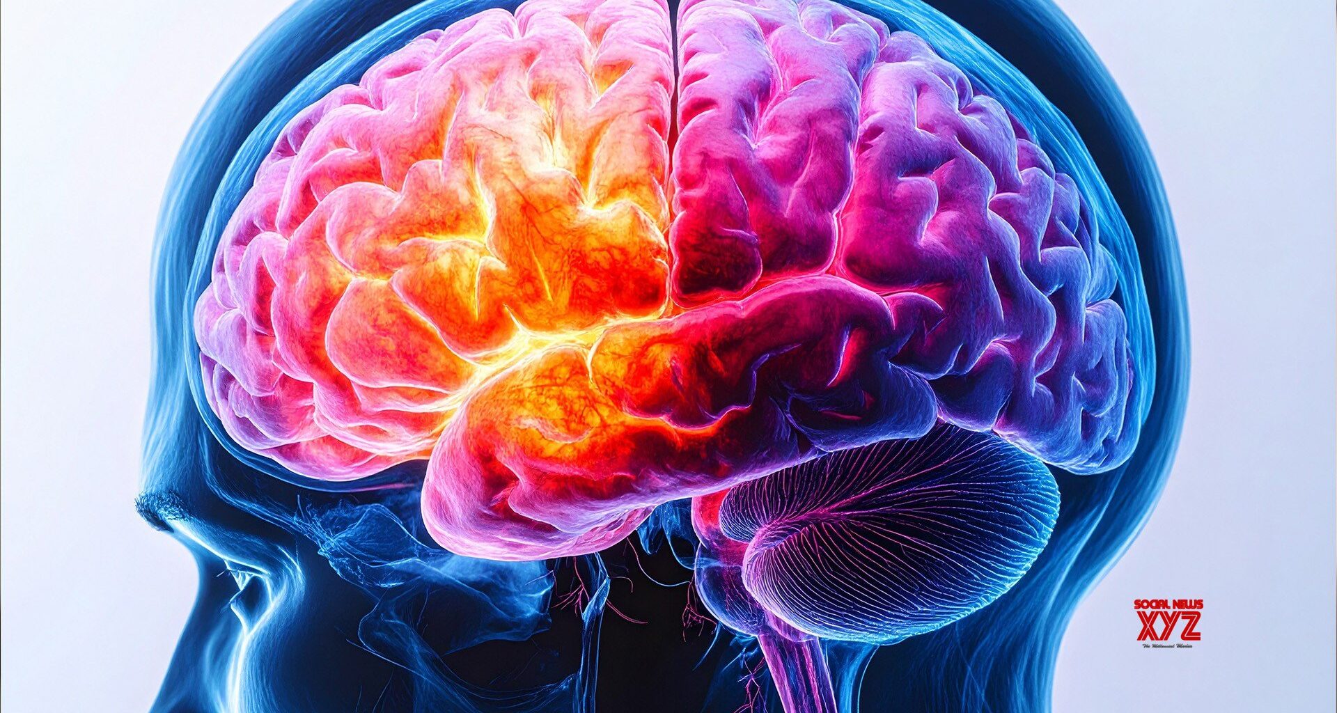 UK study identifies 8 new schizophrenia genes