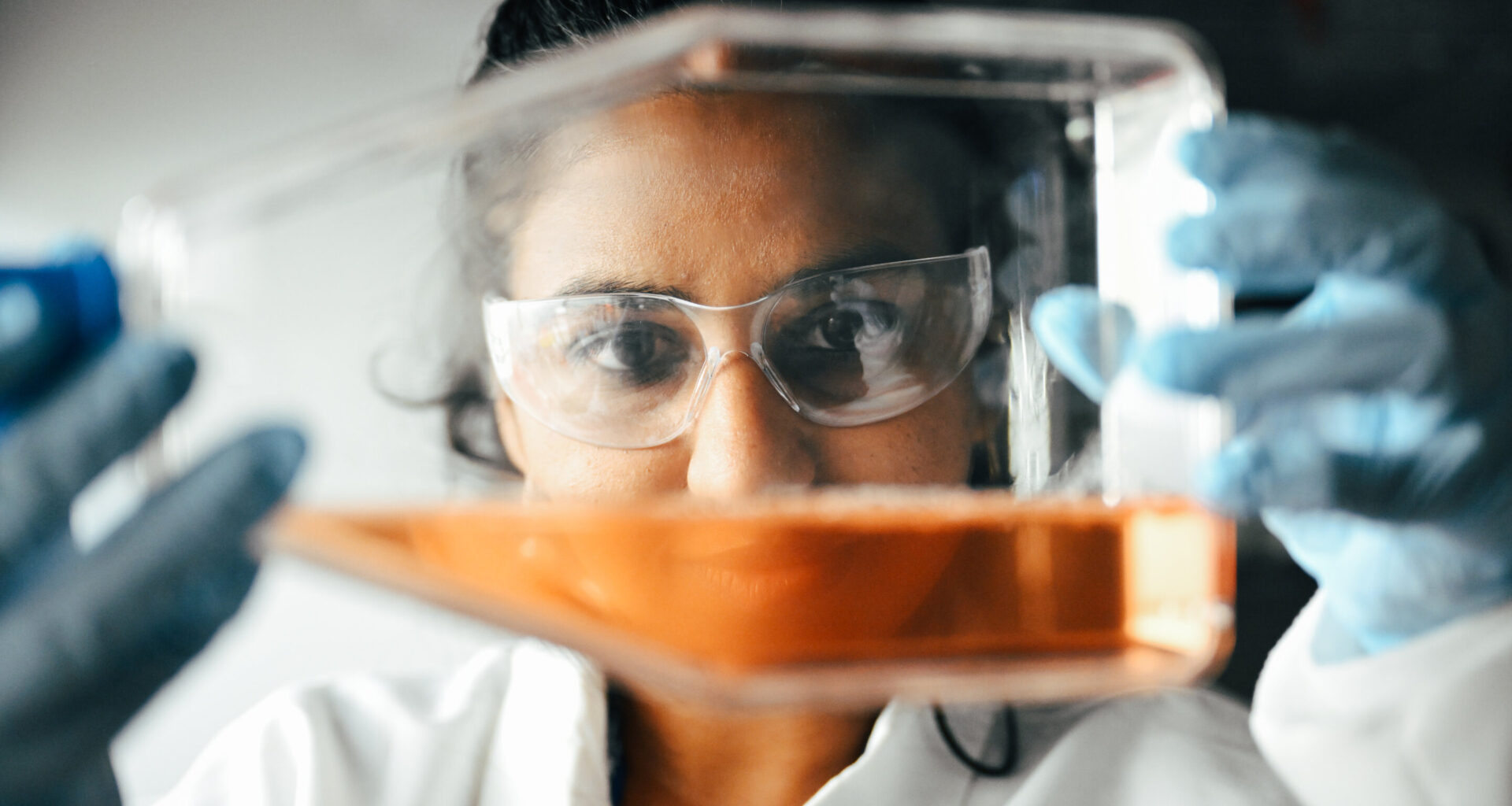 Study reveals genetic switch that helps leukemia cells evade chemotherapy