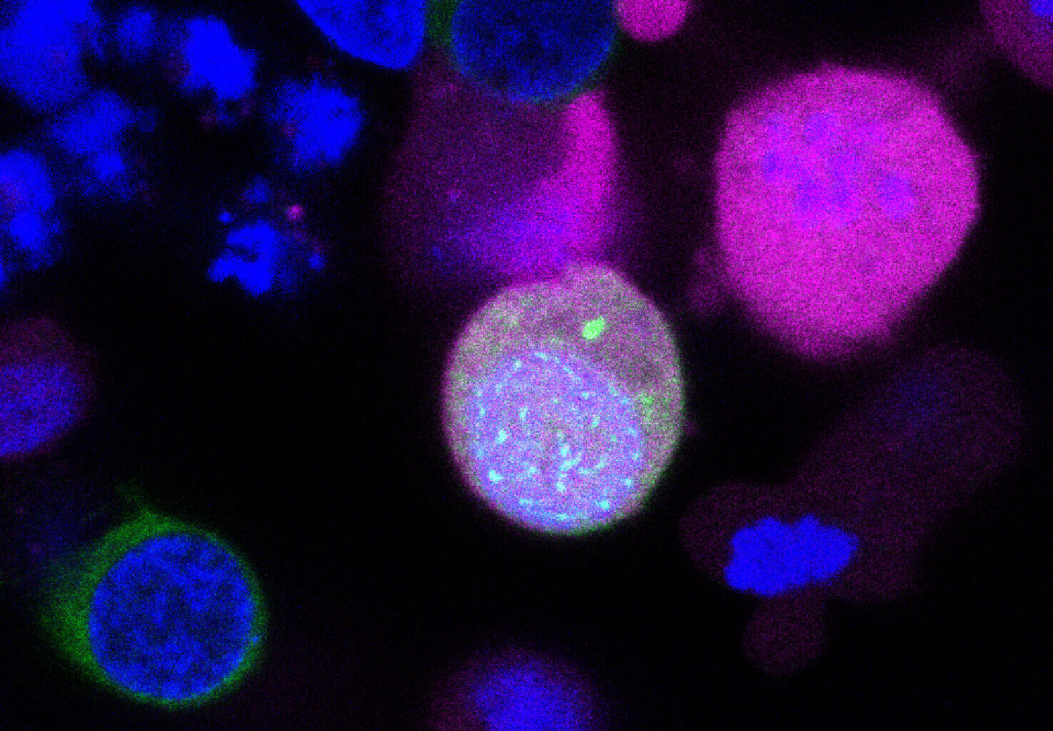 Lab-grown stem cells initiate key steps of human egg and sperm formation