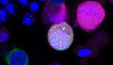 Lab-grown stem cells initiate key steps of human egg and sperm formation