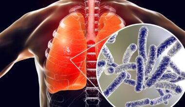 5th Legionnaires' disease death in NYC outbreak, health officials say