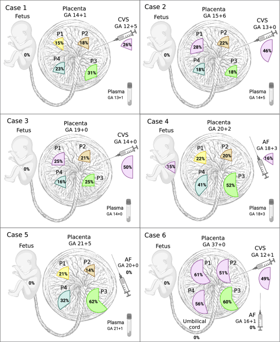Deep genome sequencing reveals extensive genetic heterogeneity in early human placentas