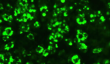 Finding microproteins to treat obesity and metabolic disorders
