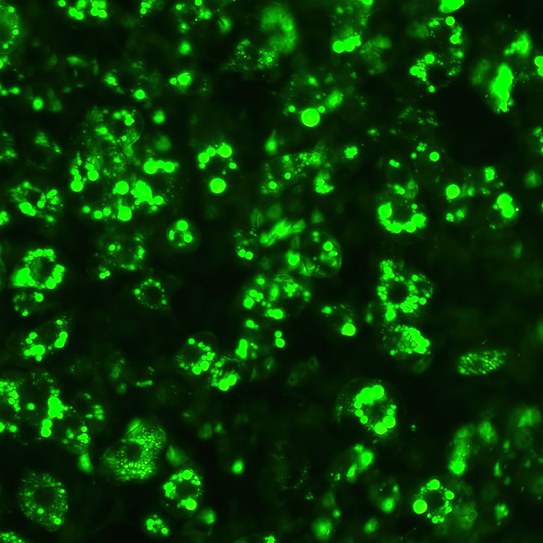 Finding microproteins to treat obesity and metabolic disorders