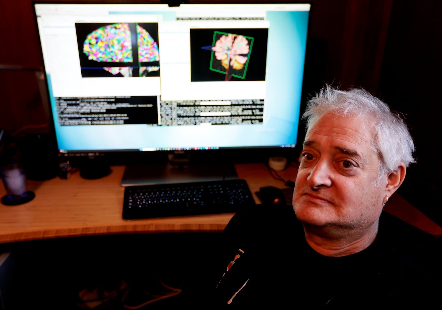 Dr. Bruce Fischl, professor of radiology at Harvard Medical School, does research on the intersection of computer science and neuroradiology at Massachusetts General Hospital.