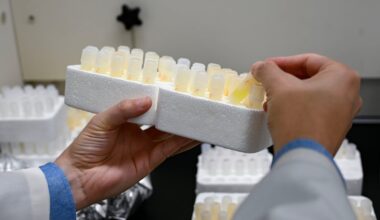 Liviu Aron, an author of a recent medical paper detailing findings about lithium’s connection to Alzheimer’s disease, examines preparations of human brain samples for analysis in the Harvard research lab.