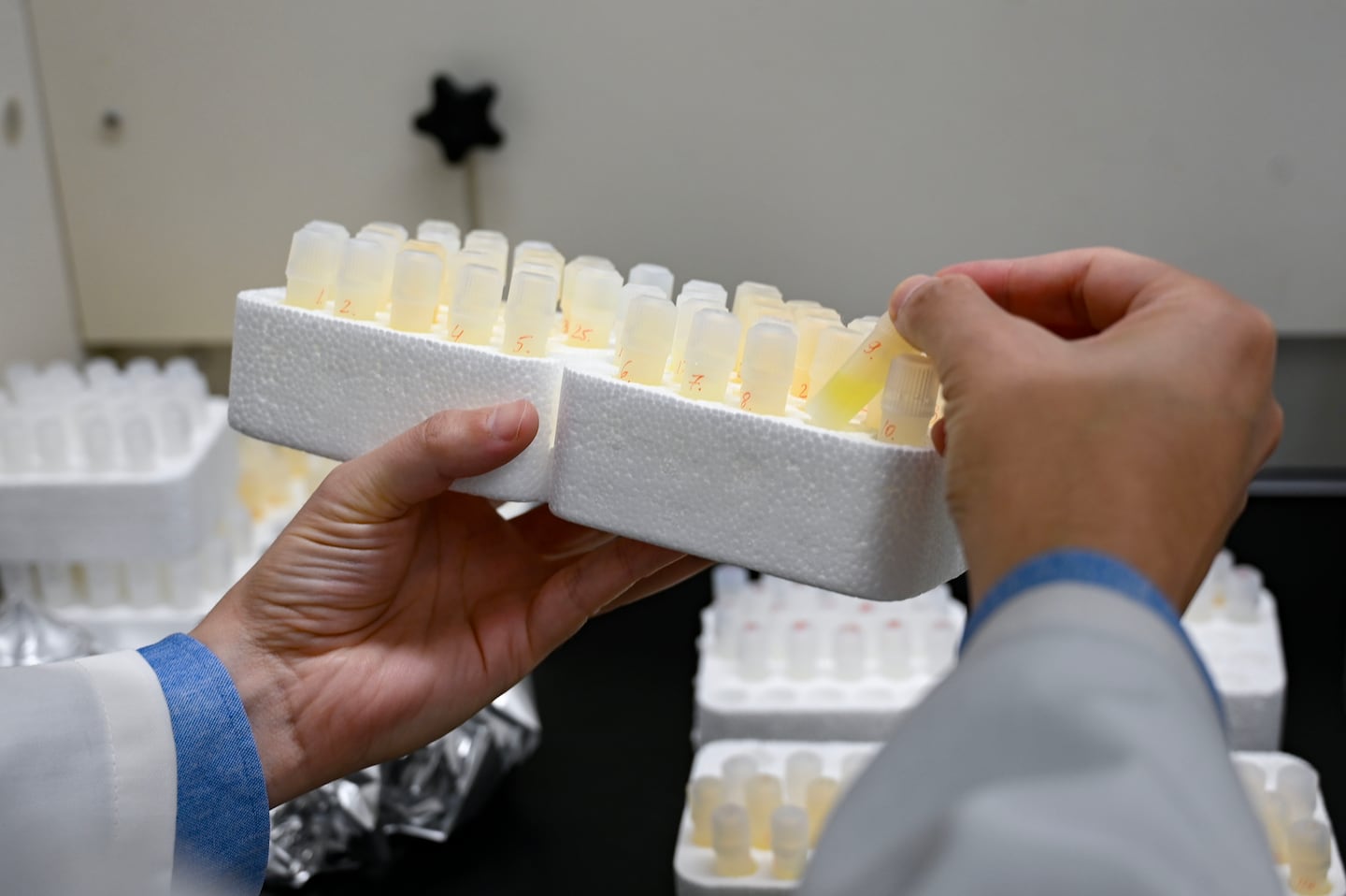Liviu Aron, an author of a recent medical paper detailing findings about lithium’s connection to Alzheimer’s disease, examines preparations of human brain samples for analysis in the Harvard research lab.