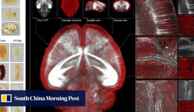 New Chinese see-through brain technique offers clearest view of its inner workings