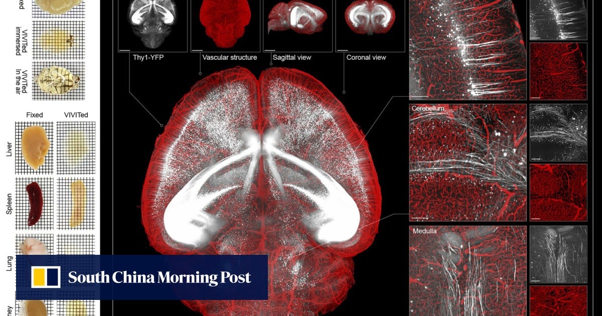 New Chinese see-through brain technique offers clearest view of its inner workings