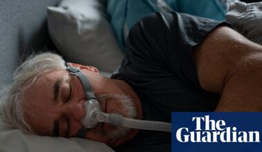‘Social apnoea’: sleep disorder could worsen at weekends, research suggests | Sleep apnoea