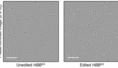 News Tips: Basic Scientists at Johns Hopkins Medicine Study mRNA Technology to Develop Promising Treatments