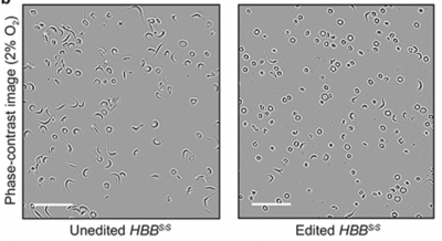 News Tips: Basic Scientists at Johns Hopkins Medicine Study mRNA Technology to Develop Promising Treatments
