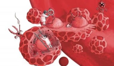 Genetic Study Suggests Ways to Catch Blood Cancer Earlier
