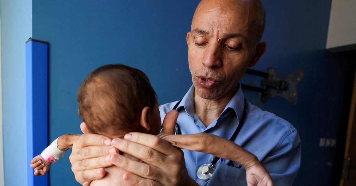 'Forced to choose who receives treatment': Malnutrition cases outpace Gaza's health system - Haaretz