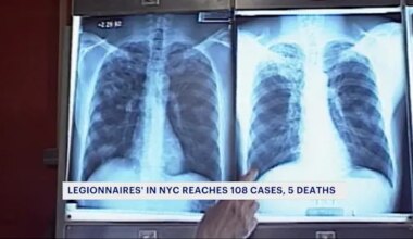 5 deaths, 108 confirmed cases of Legionnaire’s disease in New York City