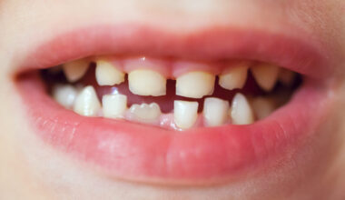 America has an oral health crisis