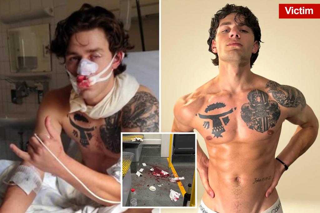 Heroic American tourist brutally stabbed while protecting two women in Germany is a model from Upstate NY