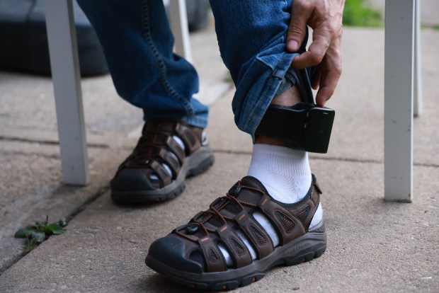 Days before Pacheco's transplant surgery, José Gregorio González shows his ankle monitor outside their apartment in Cicero on Aug. 10, 2025. (Antonio Perez/Chicago Tribune)