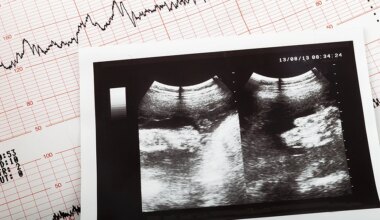 Trump administration appeals to some pro-life reproductive health care despite IVF push