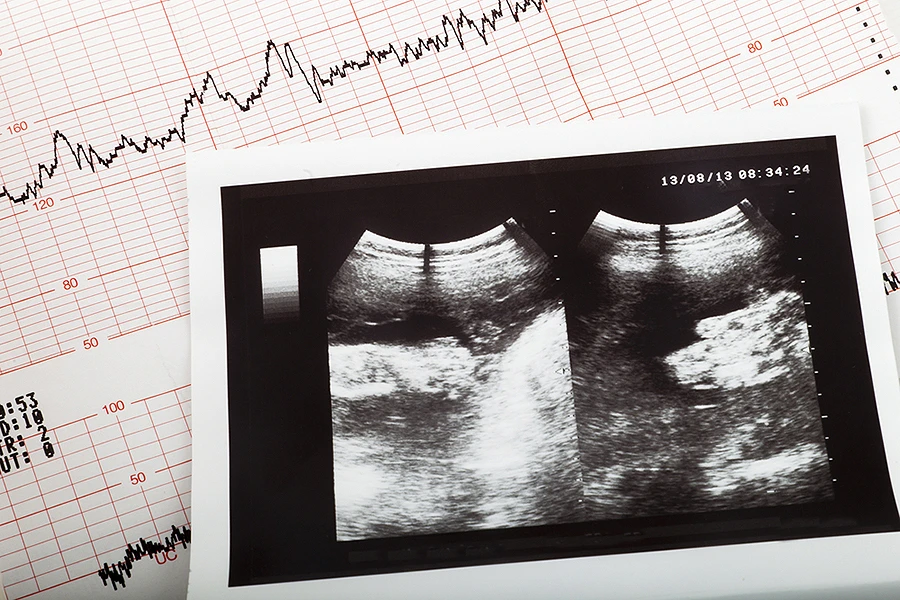 Trump administration appeals to some pro-life reproductive health care despite IVF push