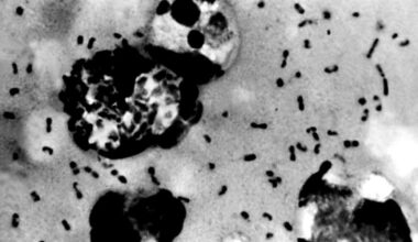 South Lake Tahoe resident tests positive for the plague