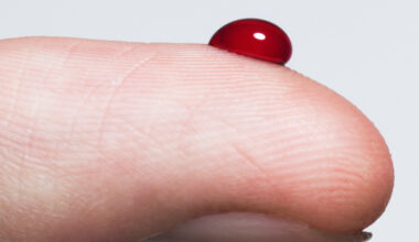 Scientists Identify How Young Blood Reverses Aging in Human Skin Cells : ScienceAlert